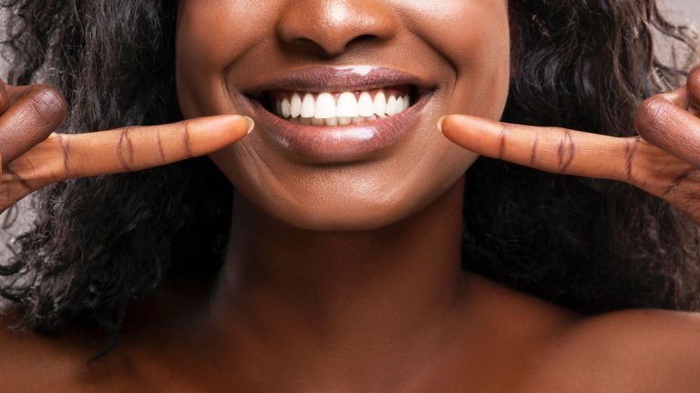 smile 2 768x432